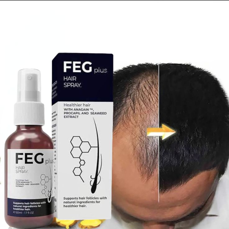 FEG Plus Hair Growth Spray