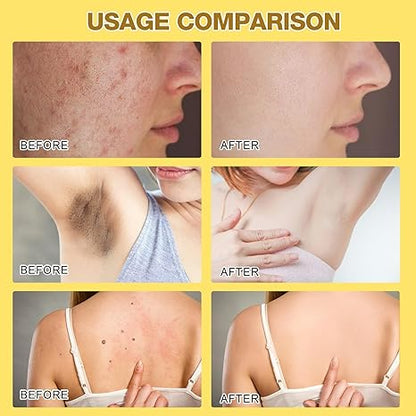 (Buy 1 Get 1 Free) Professional Bee Venom Repair Cream, For All Body Parts