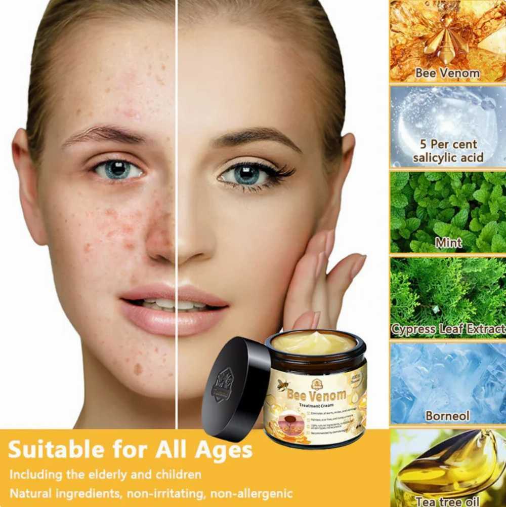 (Buy 1 Get 1 Free) Professional Bee Venom Repair Cream, For All Body Parts